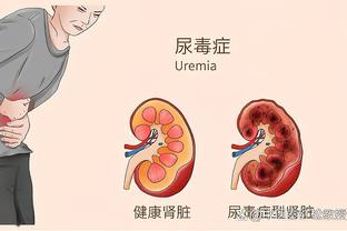 曼晚预测曼联对阵纽卡首发：奥纳纳、瓦拉内首发出战